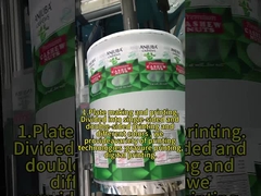 کیسه ایستادن چیه؟